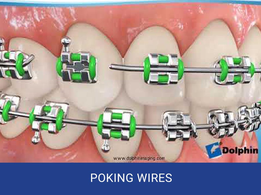 Poking Wires